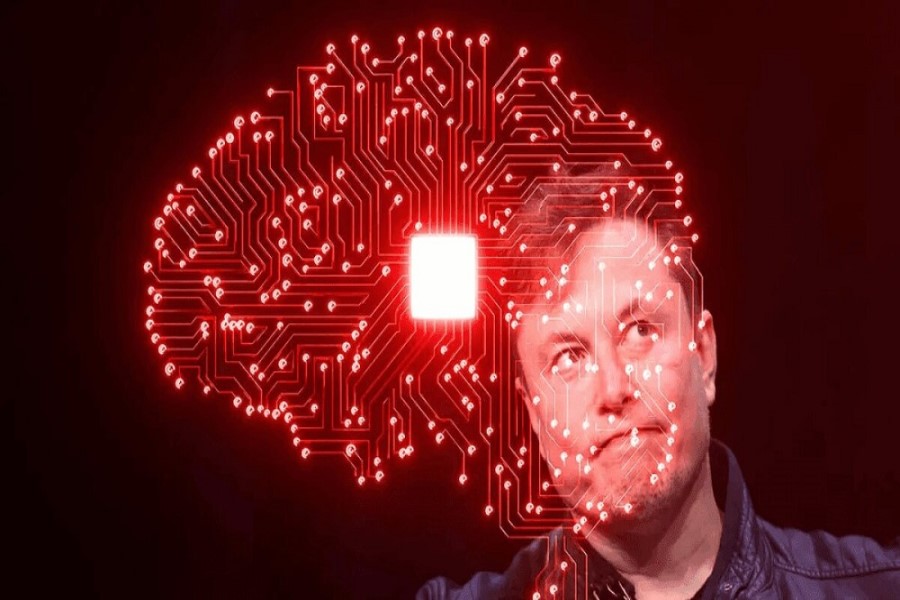 Musk beyninə neyroçip yerləşdirən ilk insanın başına gələnləri açıqlayıb